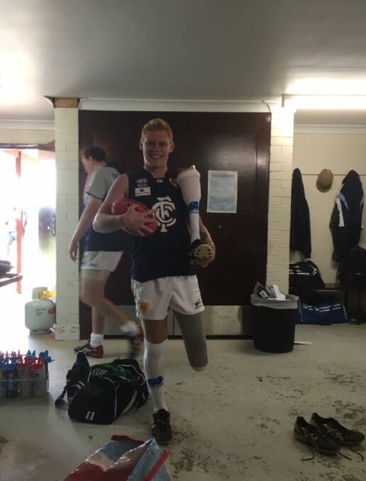 COLY CHARACTER: Blues reserve grade player Nathan Edgerton in the sheds with a footy and his prosthetic leg earlier this season.